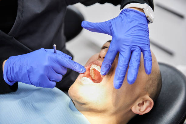 Best Emergency Tooth Extraction in Anza, CA