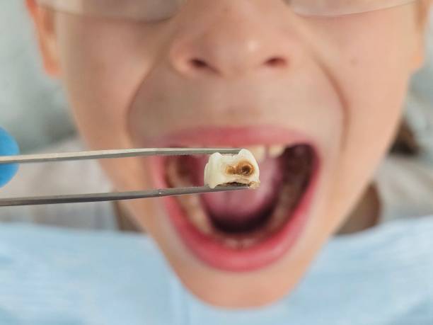 Best Same-Day Emergency Dental Services in Anza, CA